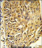 Anti-HSPA7 antibody, Internal used in IHC (Formalin-fixed paraffin-embedded sections). GTX81051