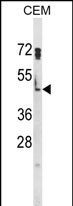 Anti-HSPA7 antibody, Internal used in Western blot. GTX81051