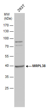 Anti-MRPL38 antibody used in Western blot. GTX120918