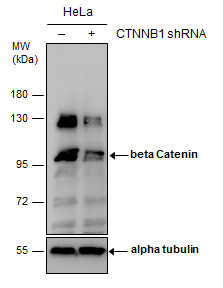 Anti-beta Catenin antibody used in Western blot. GTX101254