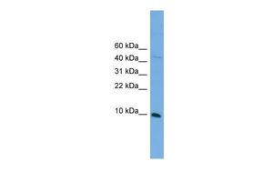 Anti-Bola2 antibody, N-term used in Western blot. GTX44662