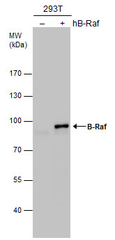 Anti-B-Raf antibody [N2C1], Internal used in Western blot. GTX100913