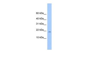 Anti-C10ORF83 antibody, Internal used in Western blot. GTX45541