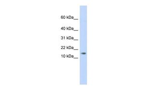 Anti-C11ORF67 antibody, Internal used in Western blot. GTX45288