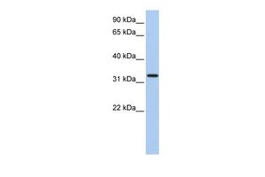 Anti-C12ORF24 antibody, N-term used in Western blot. GTX45358