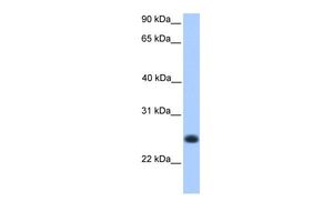 Anti-C12orf68 antibody, Internal used in Western blot. GTX45421