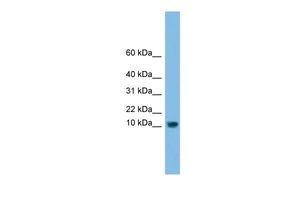 Anti-C13orf30 antibody, N-term used in Western blot. GTX45533