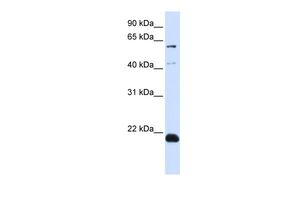Anti-C14ORF180 antibody, N-term used in Western blot. GTX46689