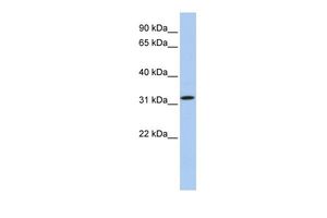 Anti-C15ORF26 antibody, C-term used in Western blot. GTX45572