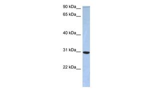 Anti-C16ORF65 antibody, Internal used in Western blot. GTX45219