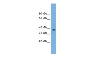 Anti-C17ORF48 antibody, Internal used in Western blot. GTX44922