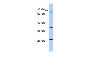 Anti-C17ORF82 antibody, N-term used in Western blot. GTX45145