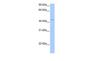 Anti-C17orf97 antibody, N-term used in Western blot. GTX45419