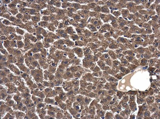 Anti-C18orf24 antibody used in IHC (Formalin-fixed paraffin-embedded sections). GTX119803