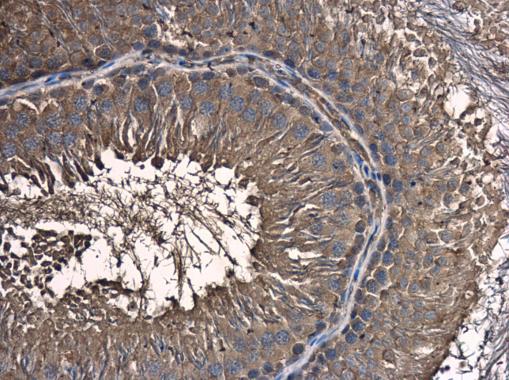 Anti-C18orf24 antibody used in IHC (Formalin-fixed paraffin-embedded sections). GTX119803
