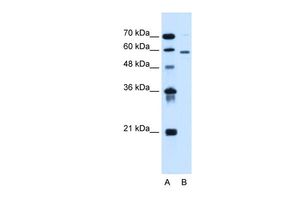 Anti-ALG11 antibody, C-term used in Western blot. GTX46717