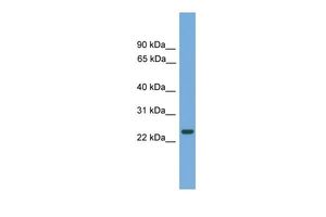 Anti-C19orf18 antibody, N-term used in Western blot. GTX45651
