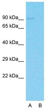 Anti-C19ORF21 antibody, C-term used in Western blot. GTX45579