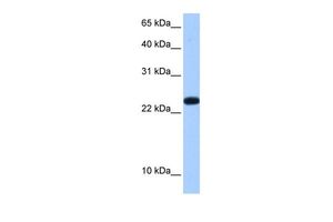 Anti-C19ORF24 antibody, N-term used in Western blot. GTX47288