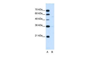 Anti-C19ORF28 antibody, Internal used in Western blot. GTX46588
