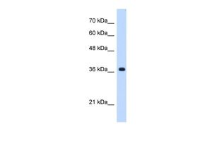 Anti-C19ORF47 antibody, C-term used in Western blot. GTX46230