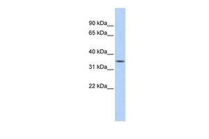 Anti-C1ORF116 antibody, Internal used in Western blot. GTX47133