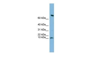 Anti-C1orf122 antibody, N-term used in Western blot. GTX45522