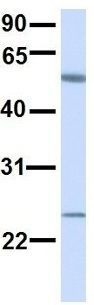 Anti-ALG6 antibody, N-term used in Western blot. GTX46386