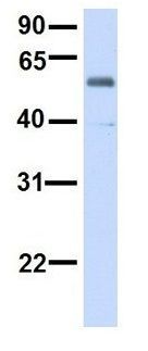 Anti-ALG6 antibody, N-term used in Western blot. GTX46386