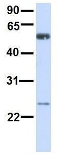 Anti-ALG6 antibody, N-term used in Western blot. GTX46386