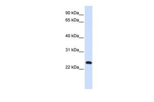 Anti-C20ORF103 antibody, Internal used in Western blot. GTX46392