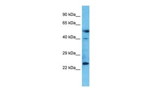Anti-C20ORF103 antibody, Internal used in Western blot. GTX46392