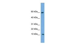 Anti-C20ORF144 antibody, Internal used in Western blot. GTX45762