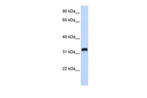 Anti-C21ORF62 antibody, Internal used in Western blot. GTX46515