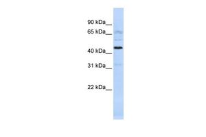 Anti-C22ORF9 antibody, Internal used in Western blot. GTX45317