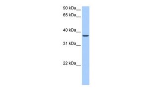 Anti-ALKBH8 antibody, N-term used in Western blot. GTX47221