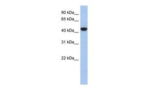 Anti-C2ORF53 antibody, Internal used in Western blot. GTX45199
