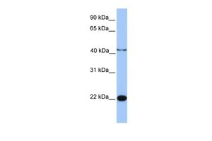 Anti-C2orf68 antibody, N-term used in Western blot. GTX45420