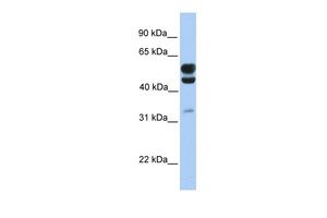 Anti-C3ORF64 antibody, C-term used in Western blot. GTX46130