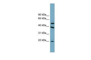 Anti-C4ORF20 antibody, Internal used in Western blot. GTX44950
