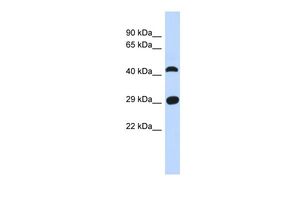 Anti-C4ORF22 antibody, N-term used in Western blot. GTX45258