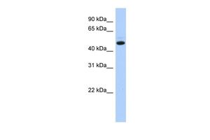 Anti-C5ORF36 antibody, N-term used in Western blot. GTX45226