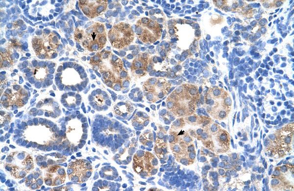 Anti-C5ORF4 antibody, N-term used in IHC (Formalin-fixed paraffin-embedded sections). GTX46976
