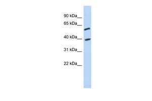 Anti-C6ORF146 antibody, Internal used in Western blot. GTX45235