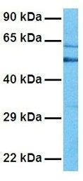 Anti-C6ORF150 antibody, Internal used in Western blot. GTX45743