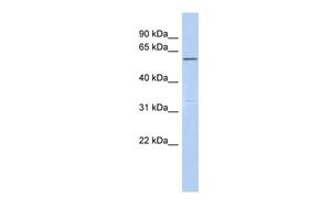 Anti-C6ORF182 antibody, Internal used in Western blot. GTX45213