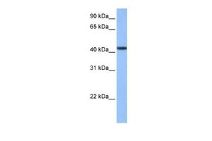 Anti-C8ORF34 antibody, N-term used in Western blot. GTX45775
