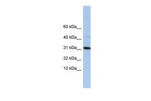 Anti-C9ORF153 antibody, Internal used in Western blot. GTX45430