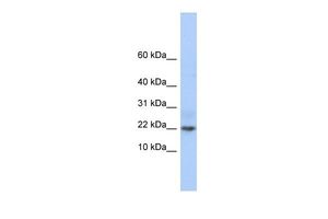 Anti-C9ORF25 antibody, Internal used in Western blot. GTX45271