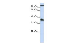 Anti-C9ORF4 antibody, N-term used in Western blot. GTX46376